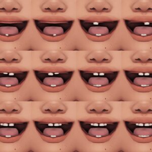 Dents de lait