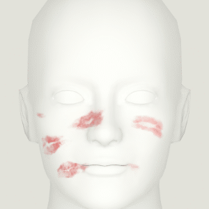Modèle Sims 4 avec éruptions cutanées faciales